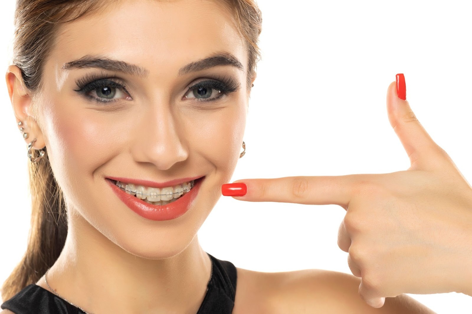 A Beginner’s Guide to Clear Braces